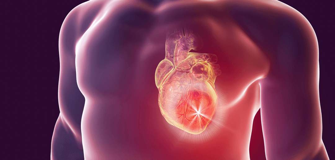 Cardiología
